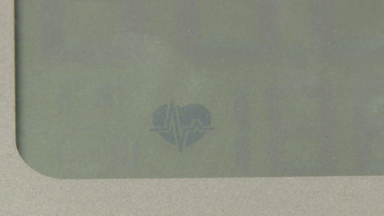 ECG display on a medical device