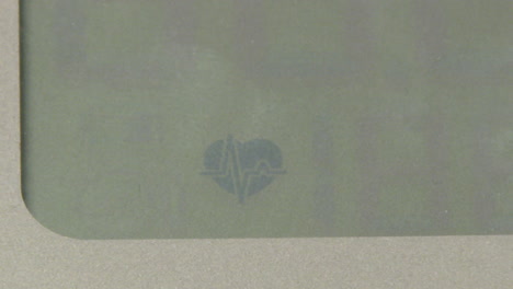 ecg display on a medical device