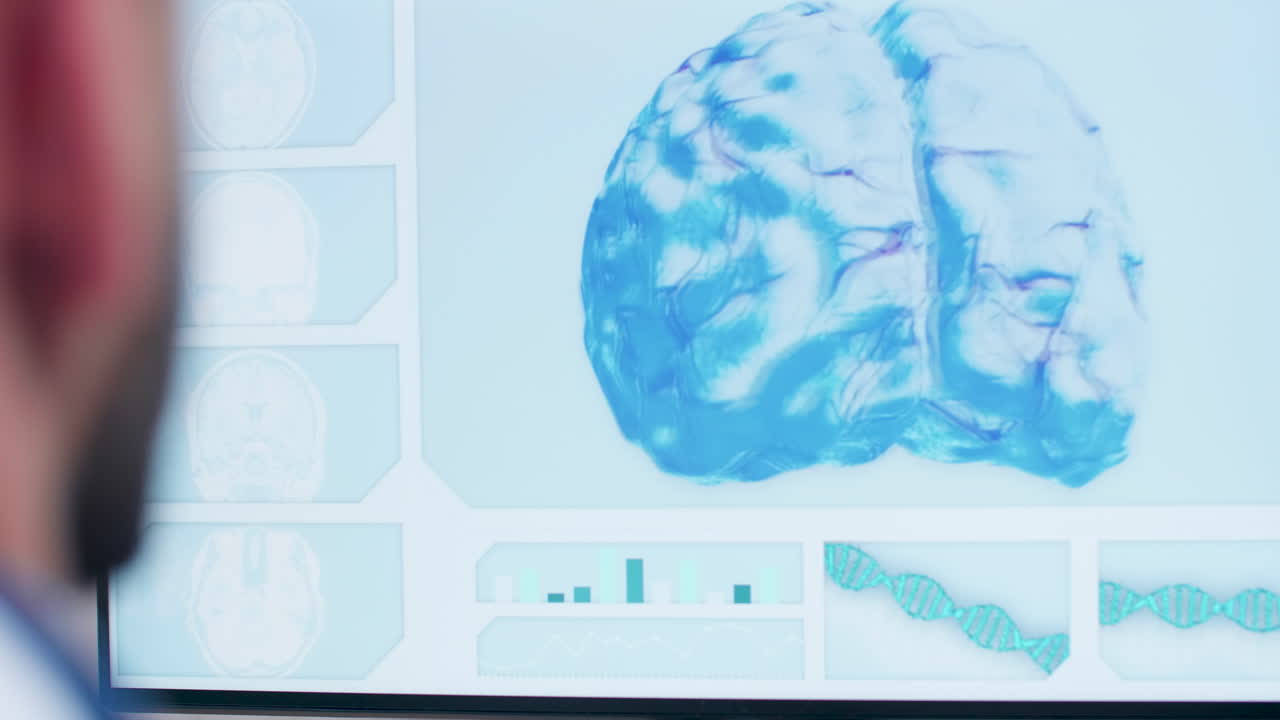 Brain Scan and DNA Analysis
