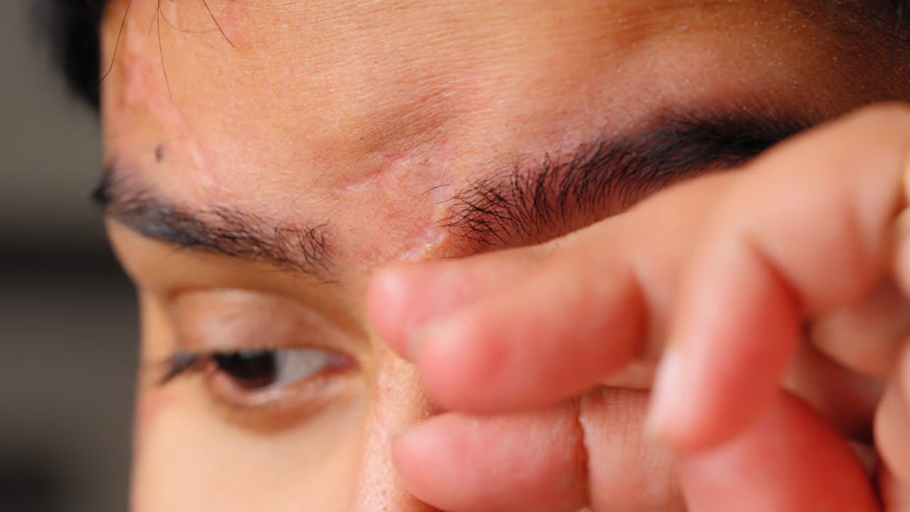 컴퓨터 화면이 화면 피로를 일으키는 것 - 안경에 반사되는 것