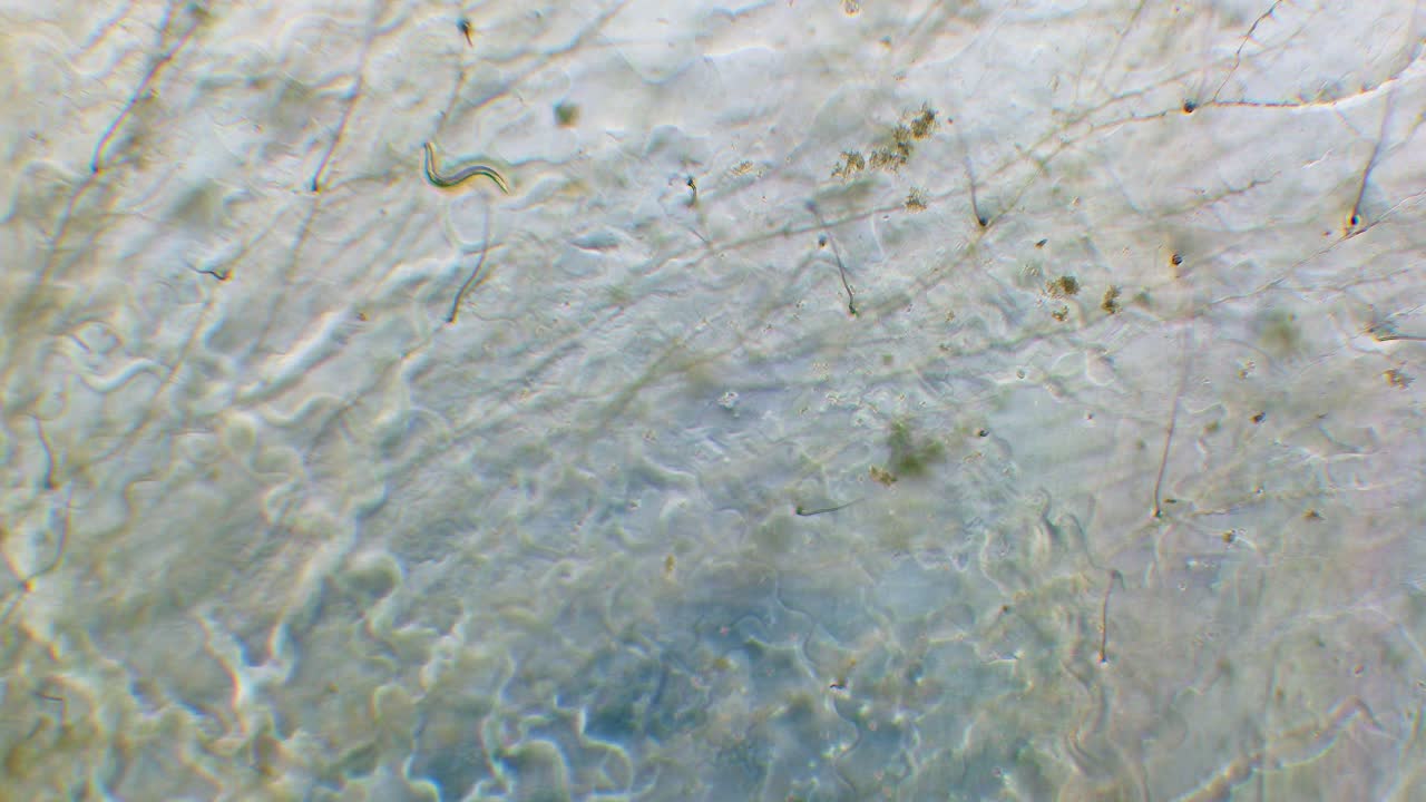 Single nemotode moving in Petri dish agar substrate