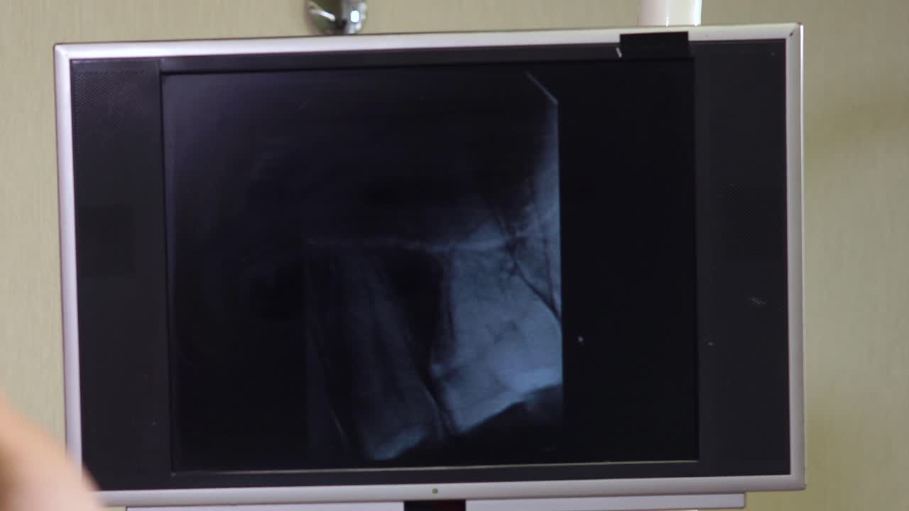 Dental X-Ray Examination
