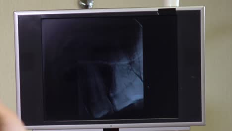 dental x-ray examination