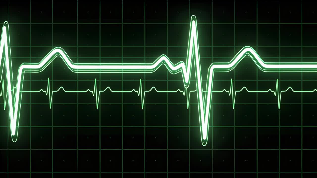 Sul picco QRS che entra da sinistra, doppia traccia ECG che si muove sulla griglia, traccia sottile che si riflette per il monitoraggio.