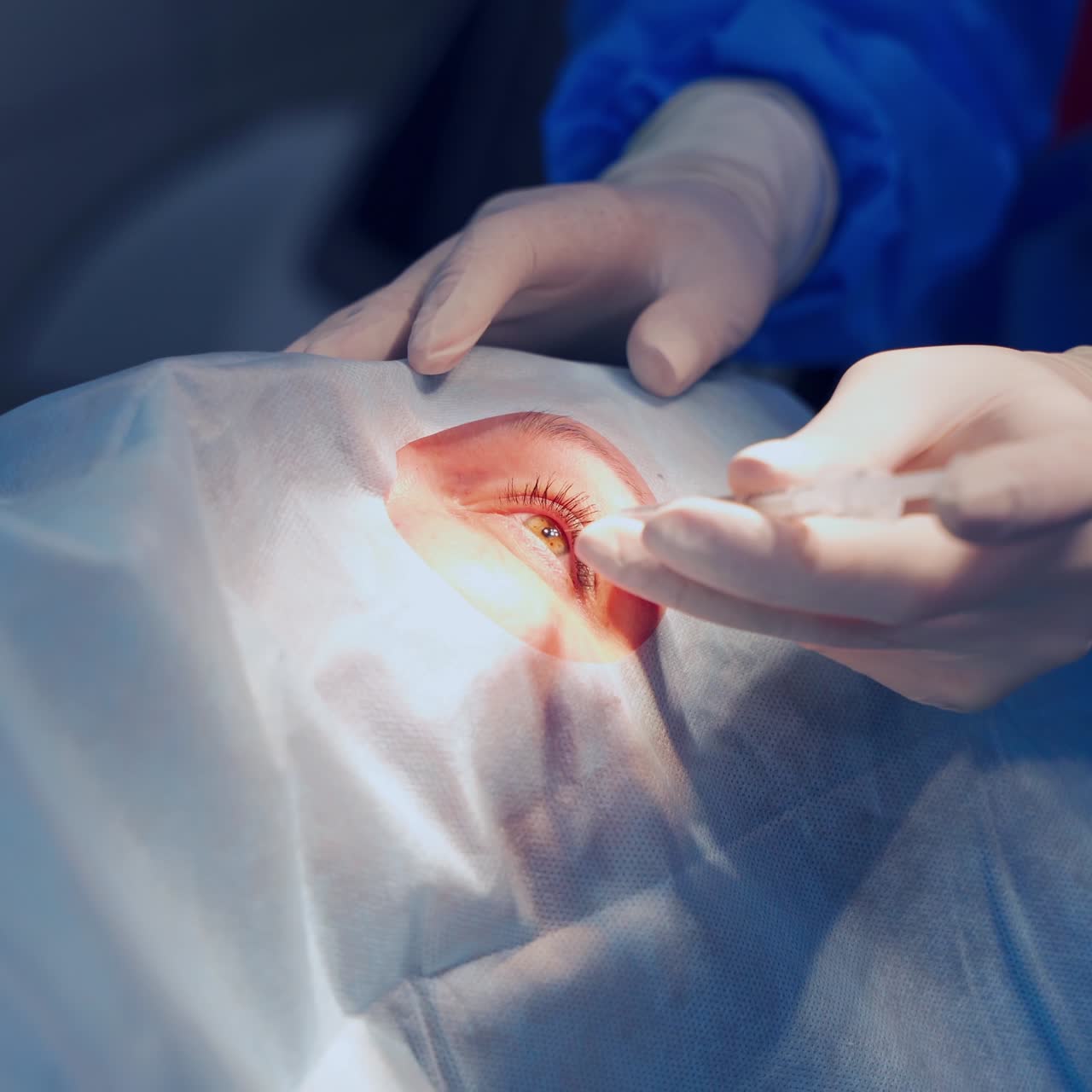 Patient under sterile cover