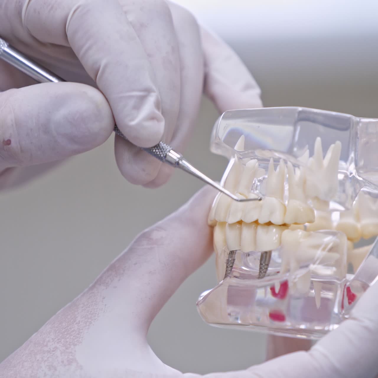 치과 의사가 이빨을 들고 있는 모델