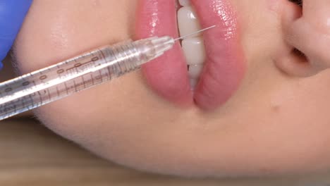 procedimiento de aumento de los labios