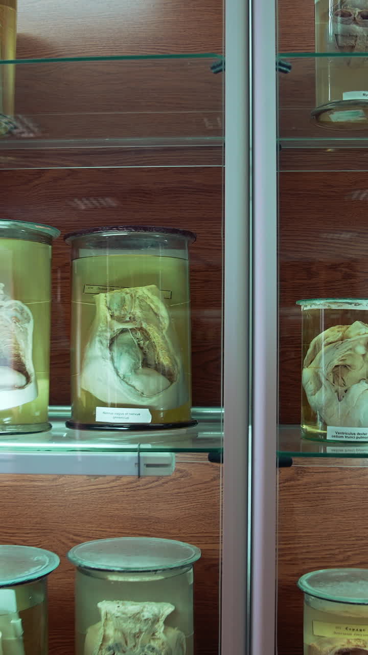 Large collection of human organs in anatomical museum. Different parts of internal organs preserved in formaldehyde on shelves. Scientific education. Vertical video