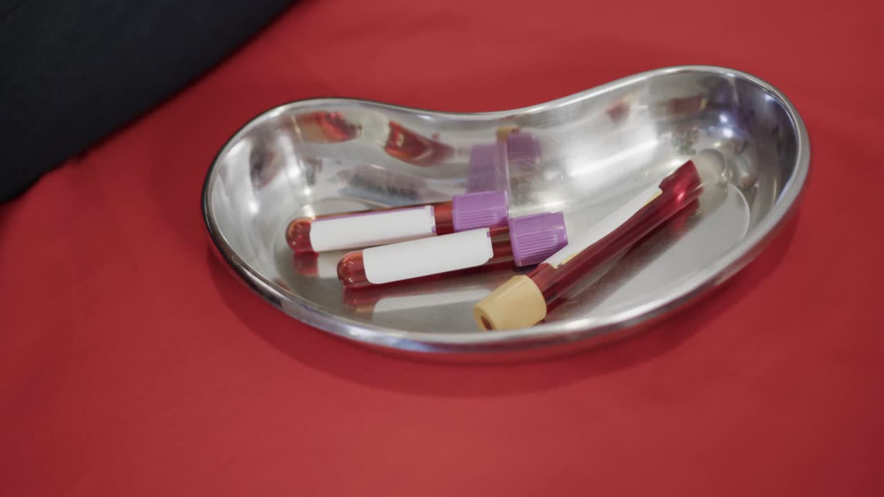 Close up of blood samples in kidney dish on red background