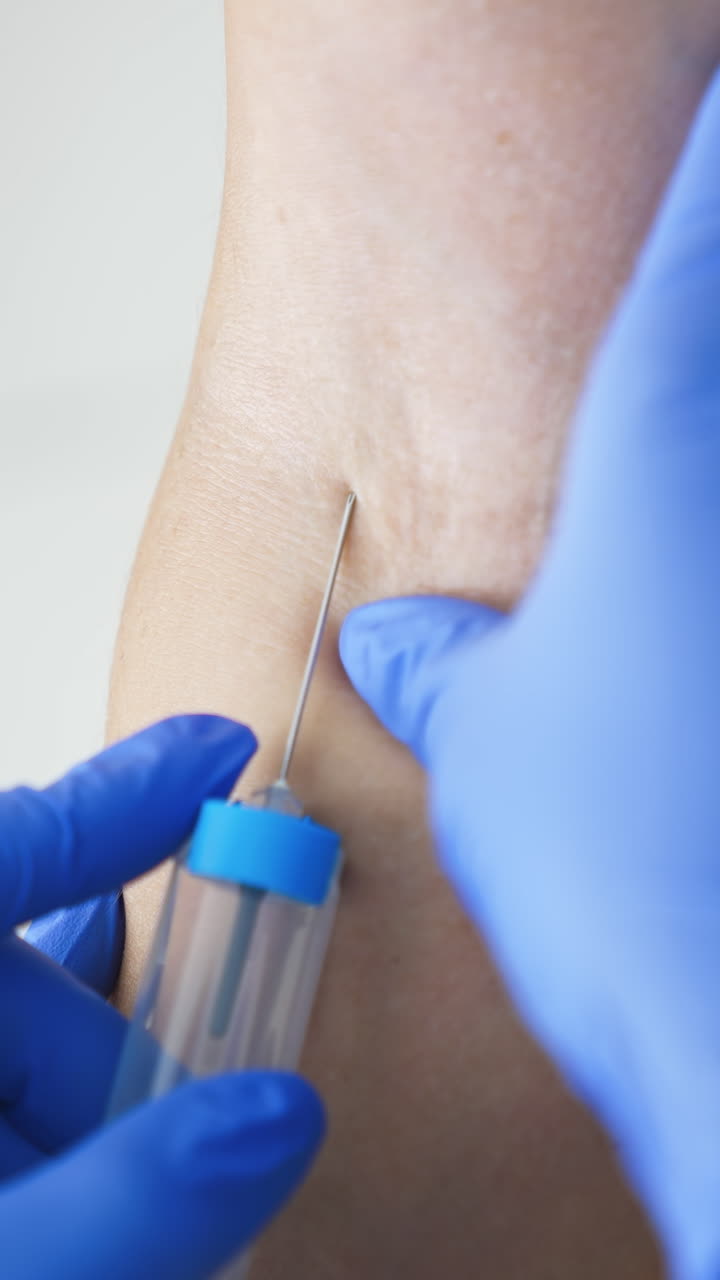 Blood sampling in the laboratory. Laboratory worker doctor takes a blood sample for analysis. Procedure of taking blood in clinic. Close-up. Vertical video