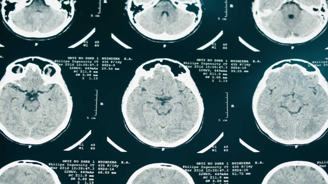 Vista ravvicinata di immagini di TAC del cervello umano