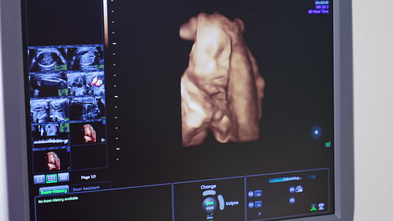 Human embryo is moving his head on an ultrasound display. Ultrasound monitor showing baby body during sonogram procedure to a pregnant woman.