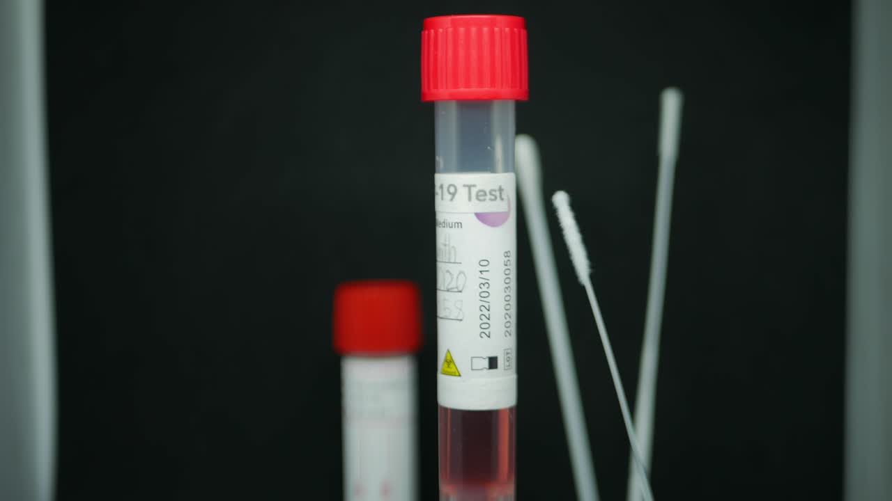 Nasopharyngeal Swab For Coronavirus In Dublin, Ireland - Test Tube With COVID-19 Test Sample Spinning With A 6-inch Cotton Swabs In The Background