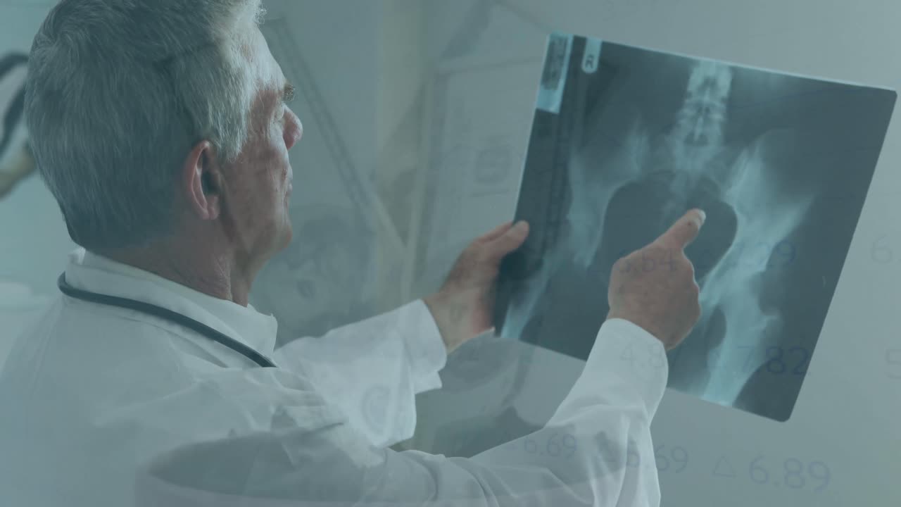 animación de fuegos artificiales y billetes de banco sobre un médico caucásico