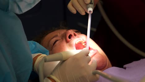 dentist uses water flosser pen tool to clean teeth as assistant handles ejector, 4k