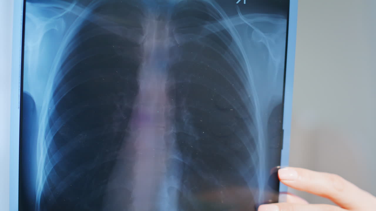 Doctor watching lungs x-ray cabinet closeup. General practitioner looking scan