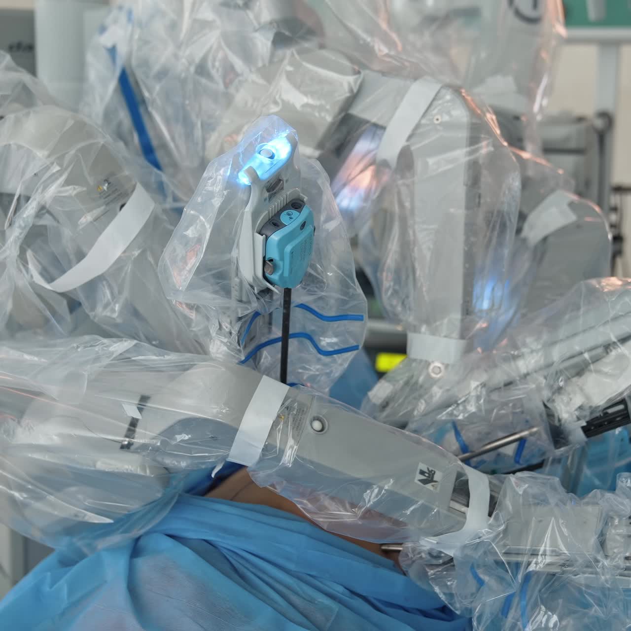 Surgery in modern operation theater. Group of surgeons at work operating in surgical theatre