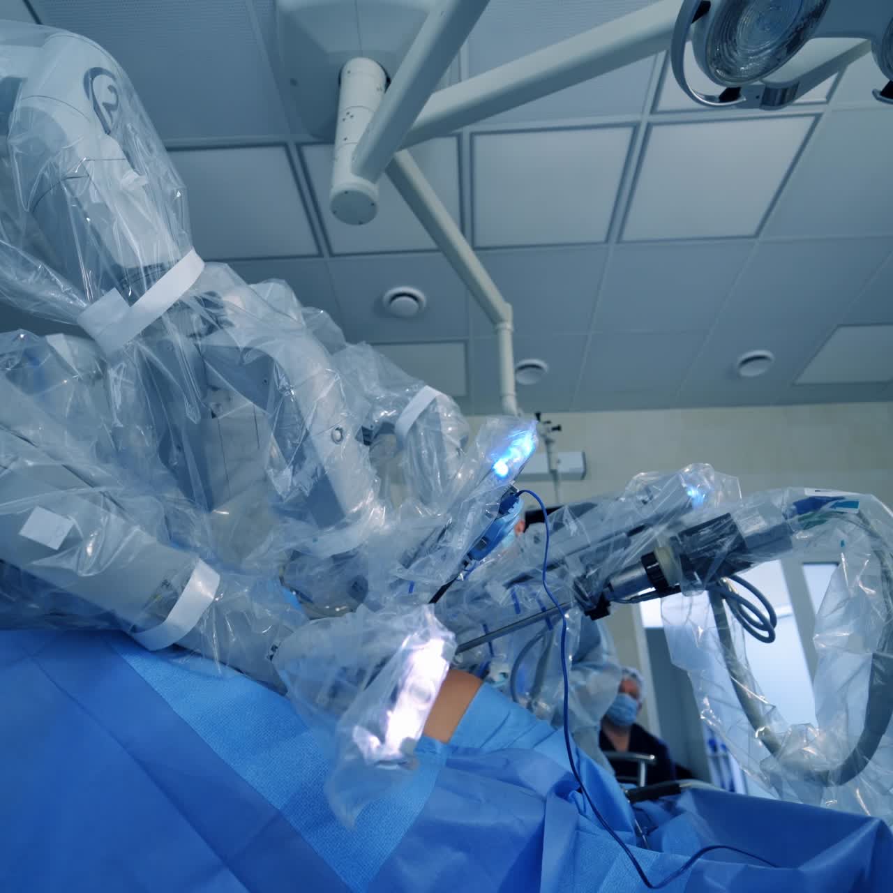 Robotic arms on patient's body. Modern medical machine with minimally invasive involvement in hospital. Futuristic surgery with robotic equipment.