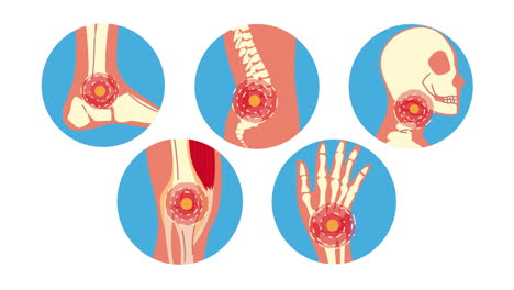 set of human pains rheumatology disease animation