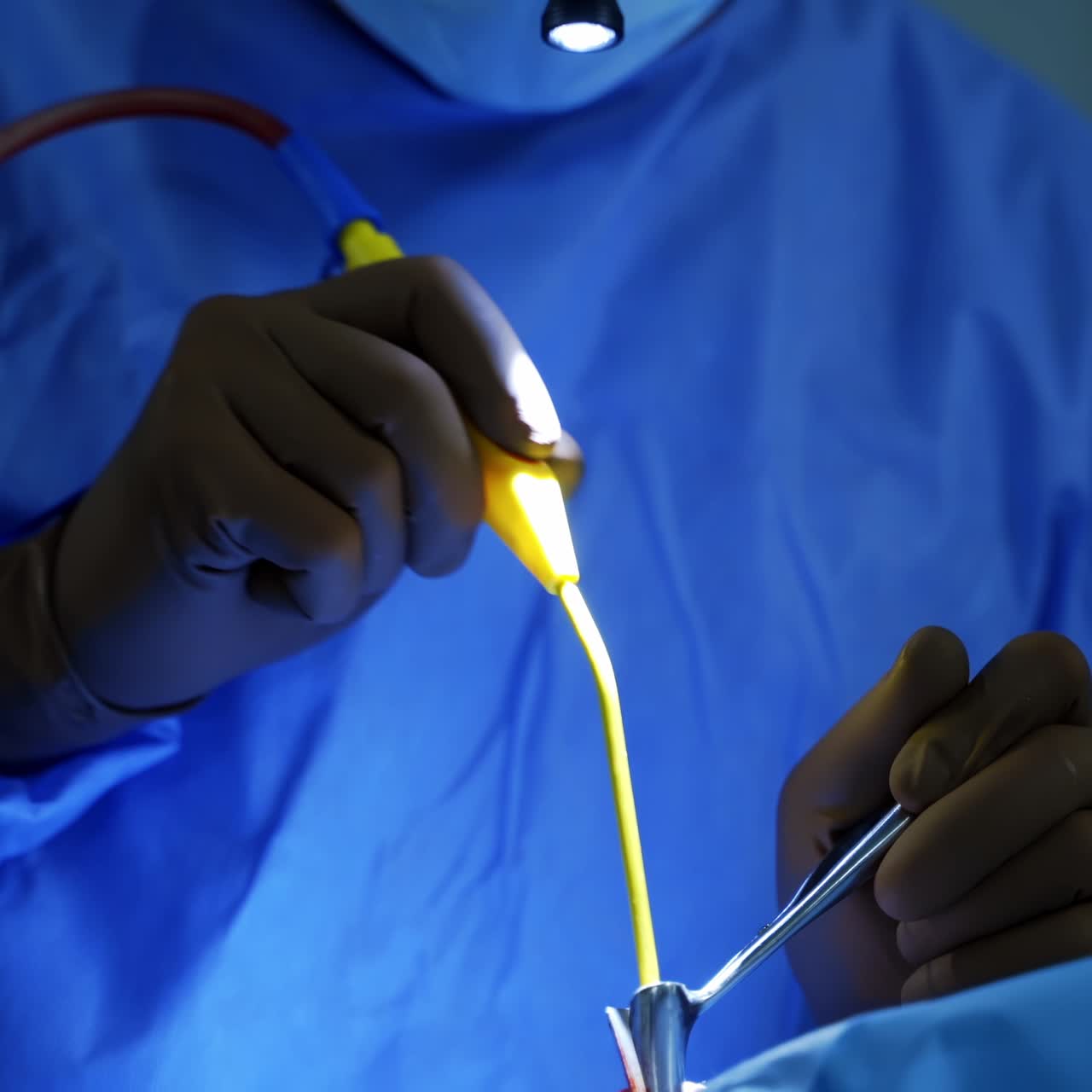 Surgical equipment used during surgery. Operating room with surgery in progress