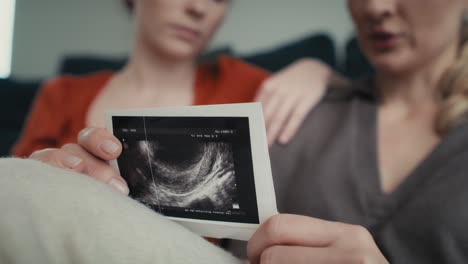 Hand-Hält-Ultraschalluntersuchung-Und-Zwei-Frauen-Im-Hintergrund.