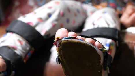 child's foot with brace