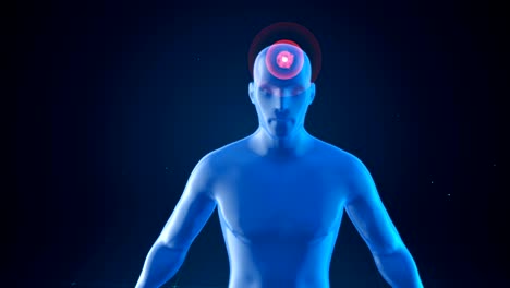 modello di un uomo con impulsi di mal di testa, concetto medico