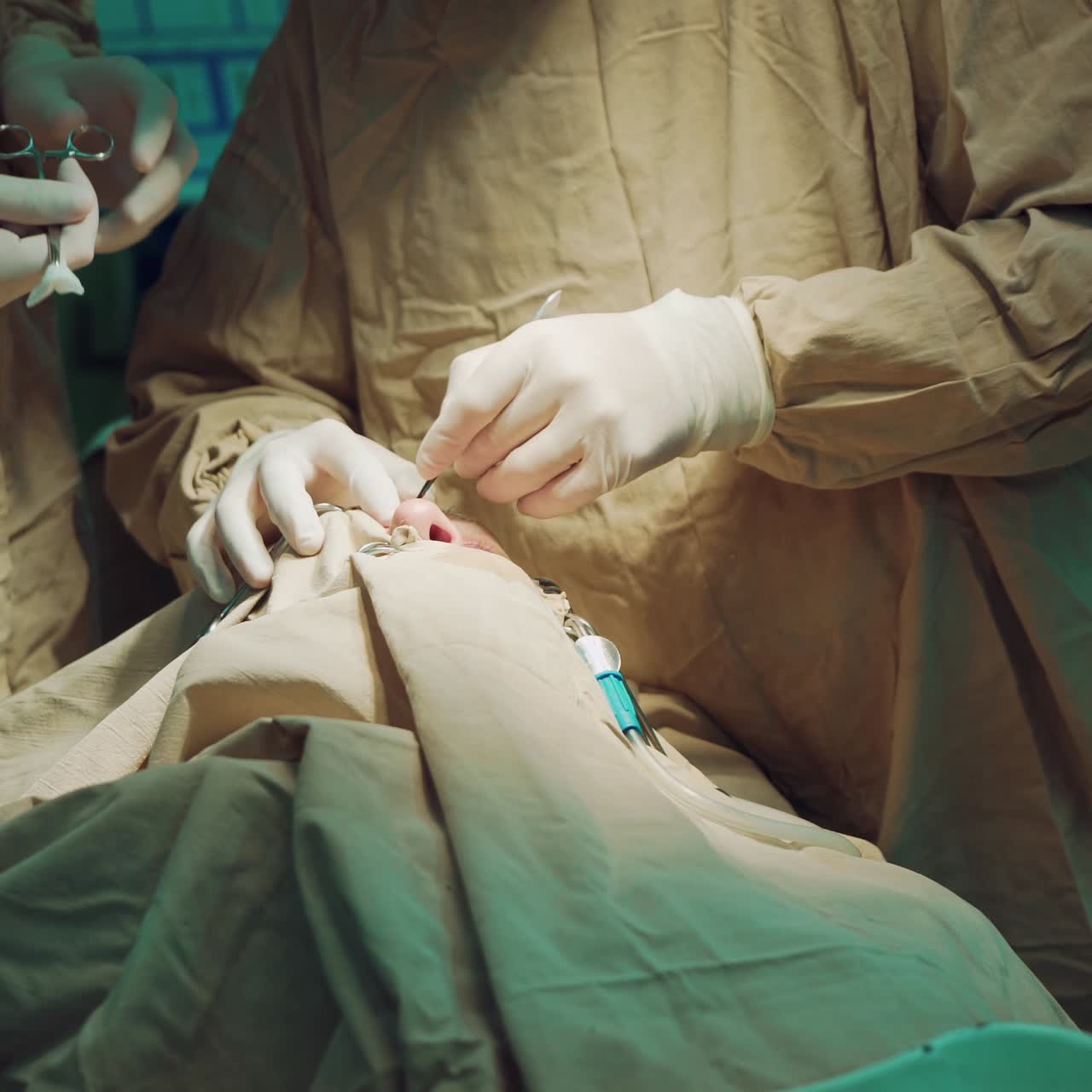 Surgeons being busy in the emergency room, performing surgery. Working with surgical instruments