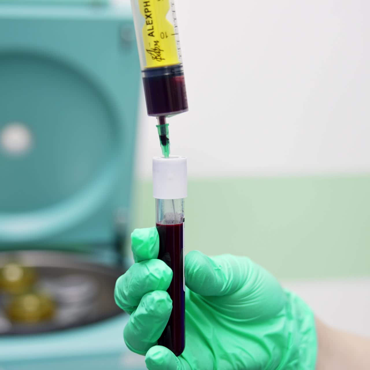Filling test tube with blood sample. Hands in latex gloves transfer blood from a syringe to a little reservoir for plasma extraction. Close up. Blurred backdrop