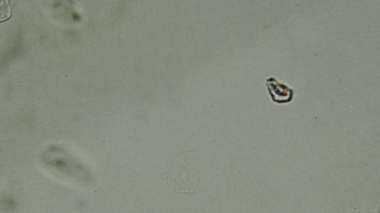 Microscopic View of Single-Celled Organisms Moving in Fluid