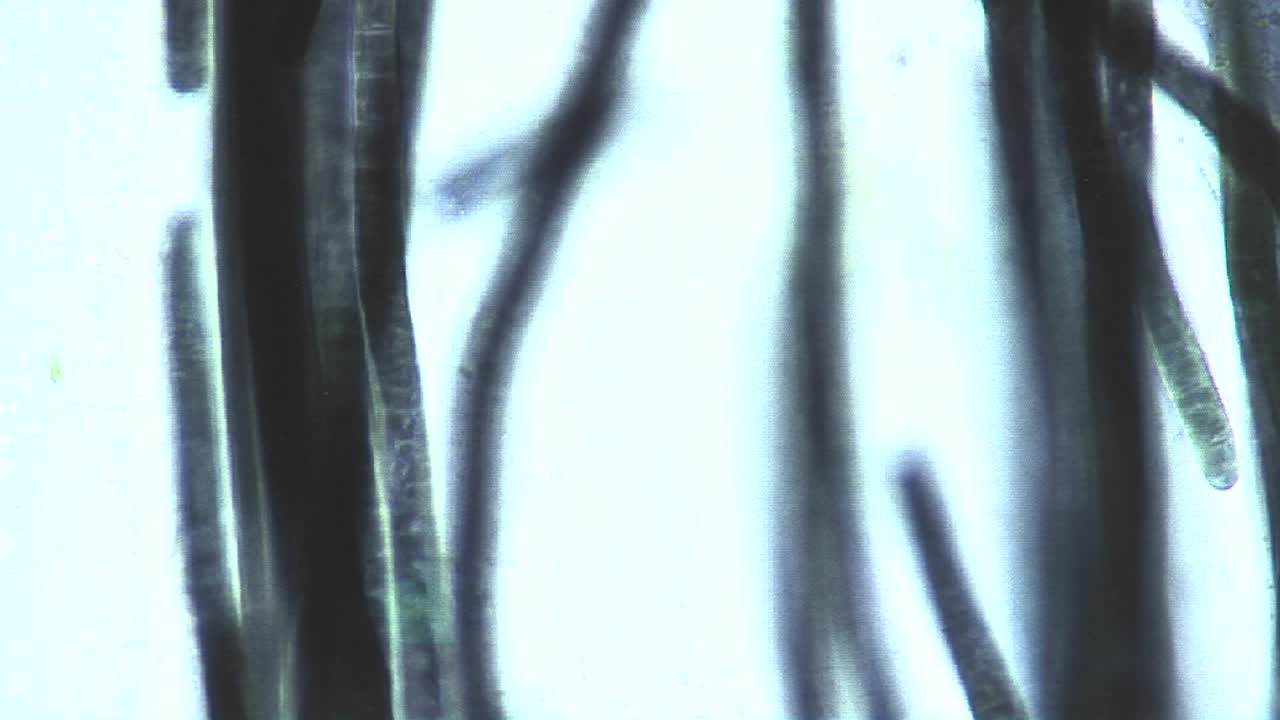 vista microscópica de algas verde azul phormidium 1