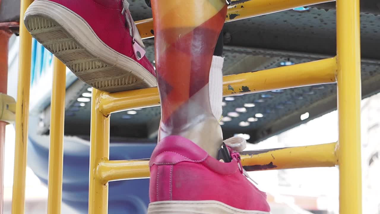niño con pierna protésica subiendo por una escalera de parque infantil