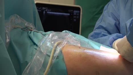 endovenous laser ablation is a commonly used and very effective minimally invasive therapy to manage leg varicosities