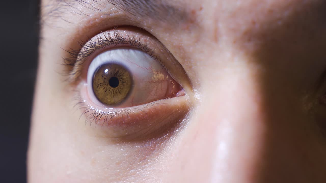 가까운 눈. 정신병자의 눈.