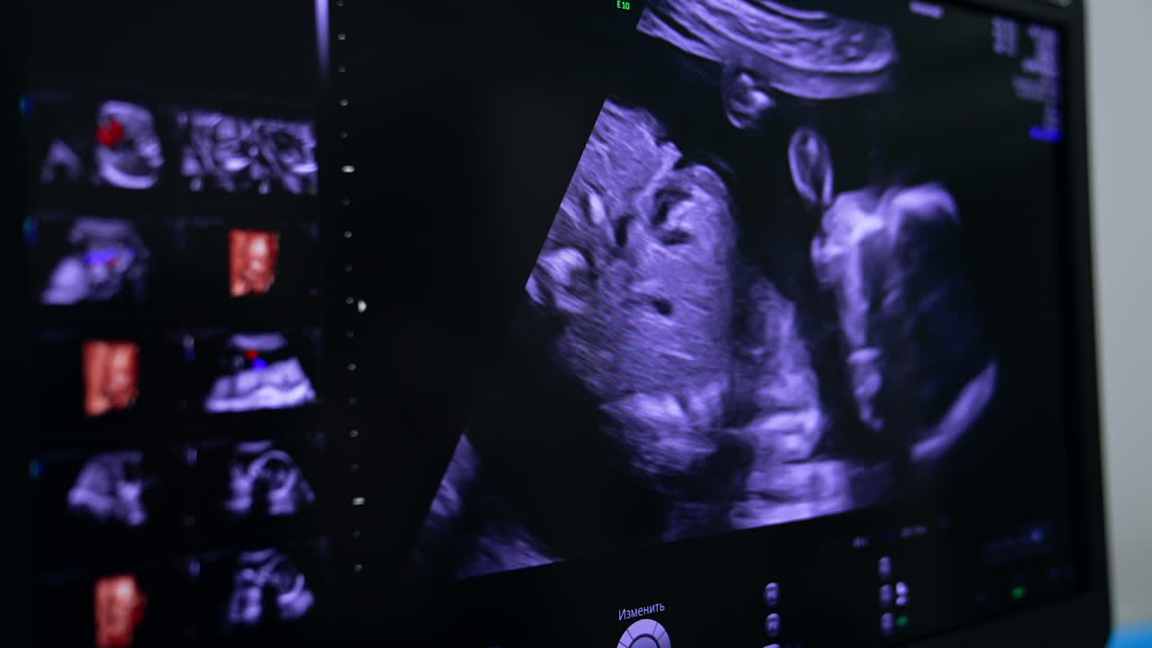 Image of a baby moving in the mom's womb. Monitor of ultrasound machine close up.