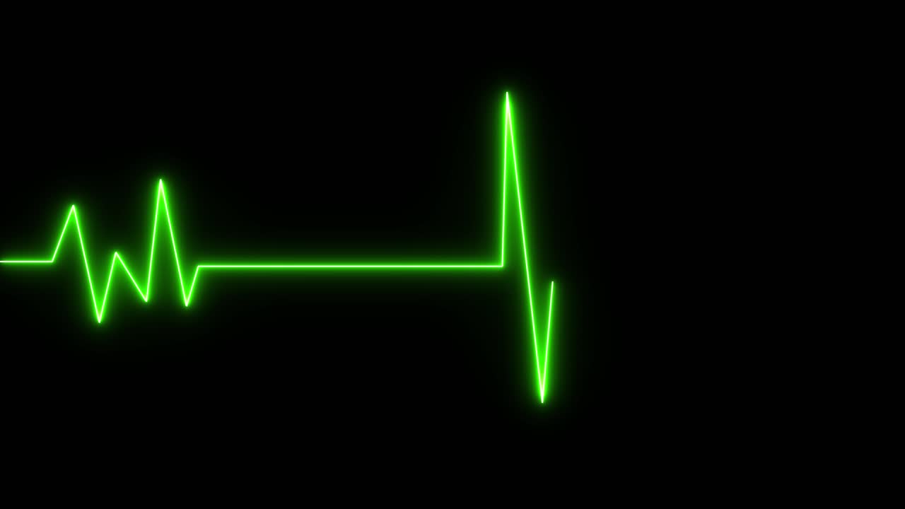 светящийся неоново-зеленым цветом график частотной линии