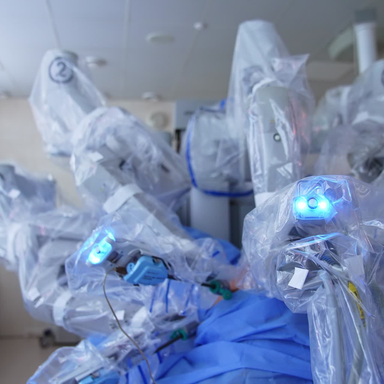 Complicated highly-precise robotic equipment operating the human. Technological equipment in present-day surgery theatre