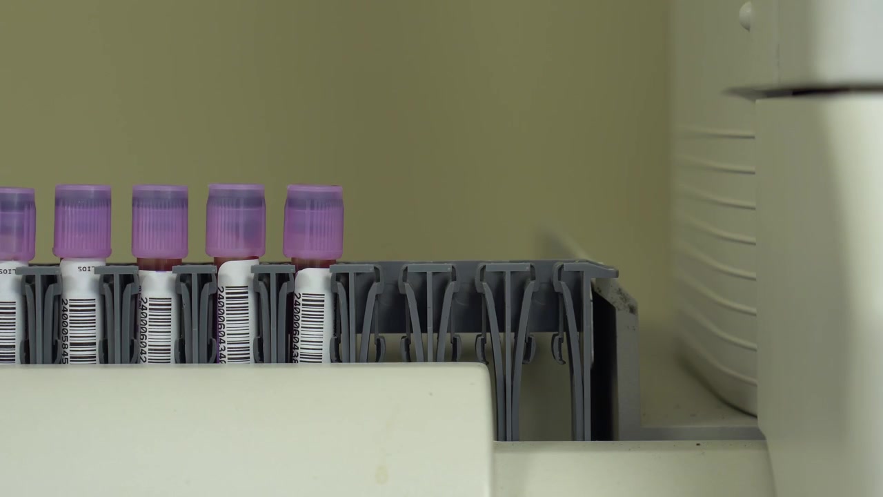 Blood samples in test tubes with purple caps placed in a lab rack for clinical analysis