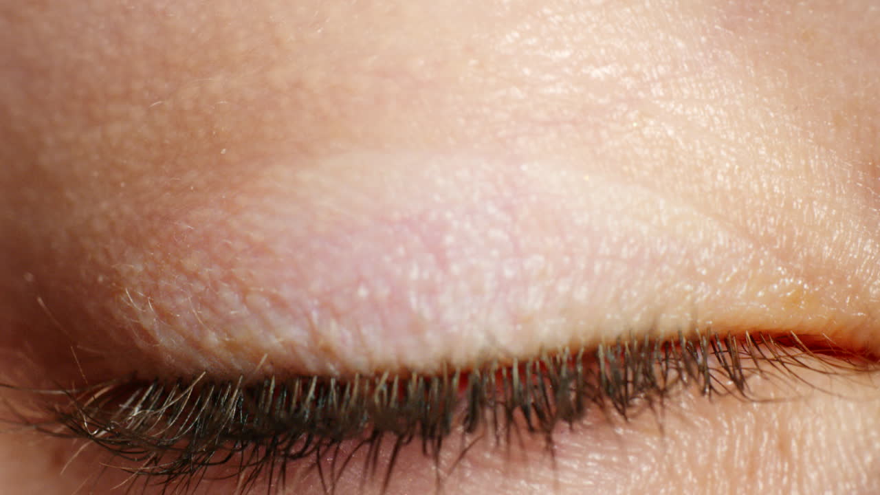 깨어있는 사람의 시야, 파란 눈과 매크로