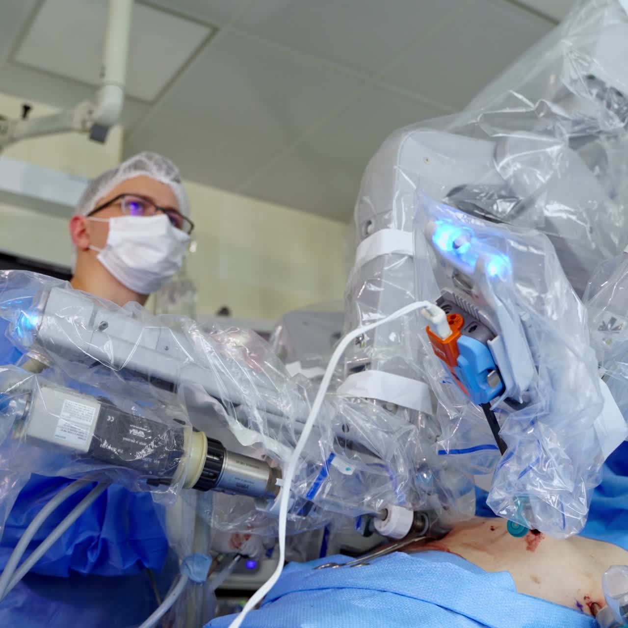 Robotic arms in patient during surgery. Futuristic medical equipment in the operating room. Surgeon conduct an operation with a robotic system. Close-up