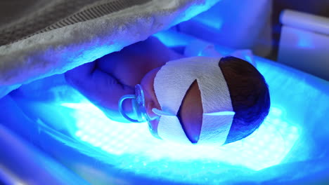 naked newborn baby with bandage on eyes lies on uv lamp. infant having higher level of bilirubin is treated by phototherapy.