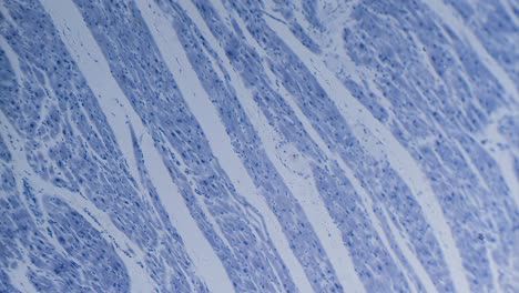 cardiac muscle section, stained, view in microscope bright field
