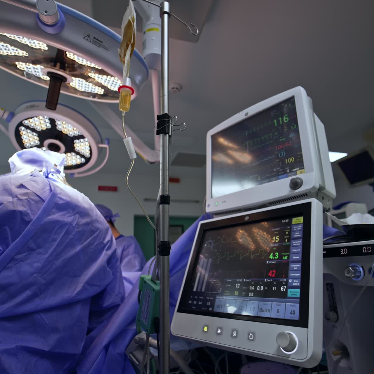 Monitors of artificial lung ventilator showing the life signs. Rear view of surgeons operating the patient. Low angle view