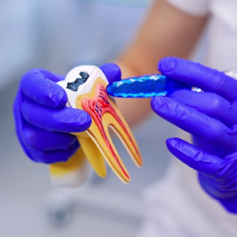 plastic model of tooth. hands in blue gloves of a professional dentist holding a tooth mock and explaining on it. close-up