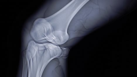 an x-ray clearly displays the detailed structure of a human knee. this examination highlights bones, joints, and potential areas for injury within a clinical analysis.