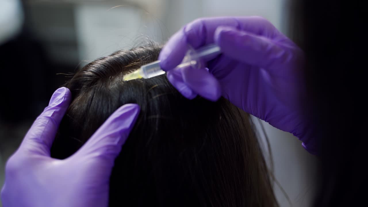 A beautiful young woman receives an injection in the head in the center of aesthetic medicine. Prevention and treatment of hair growth