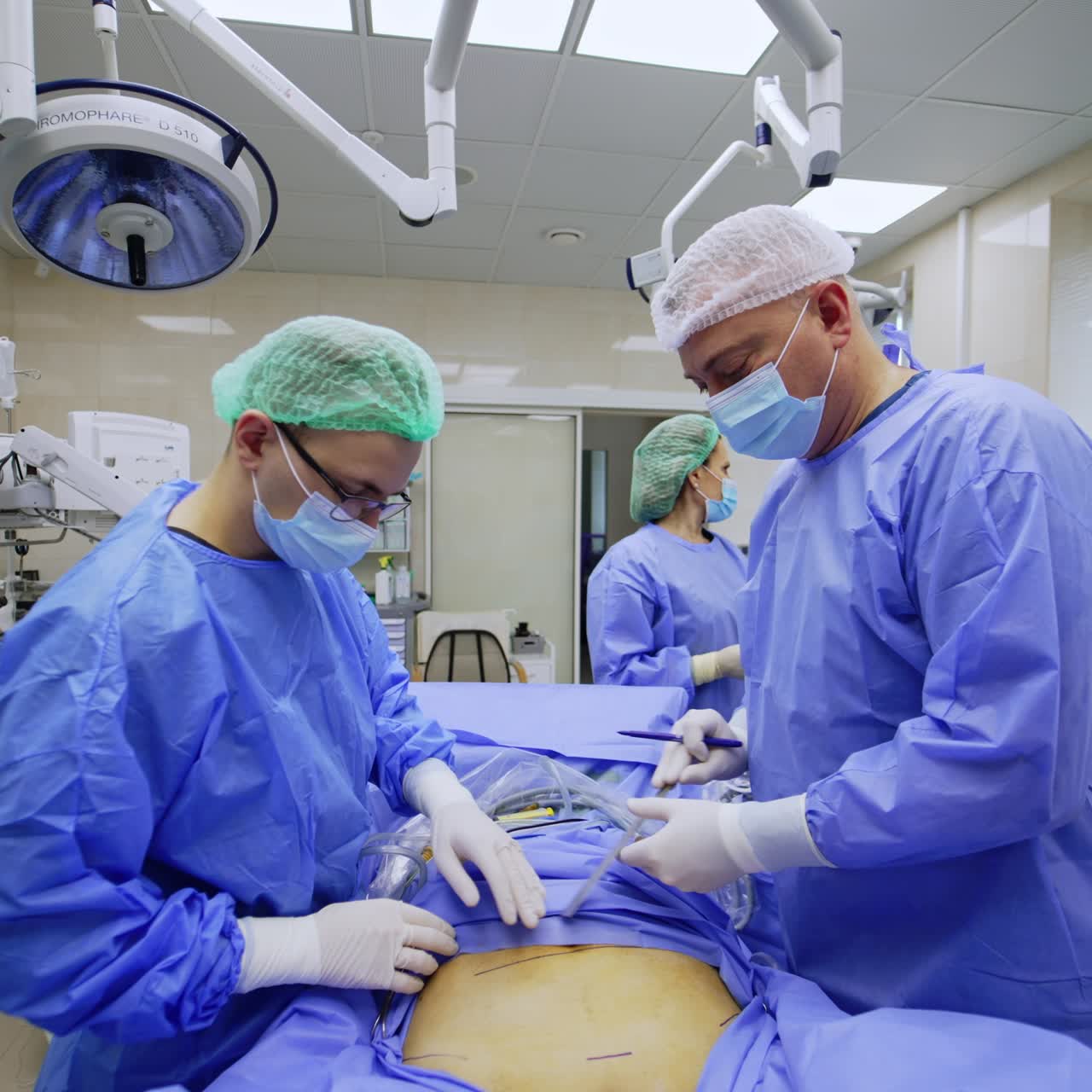 Surgeons marking the places of incision before the surgery. Laparoscopic procedure with the help of Da Vinci robot