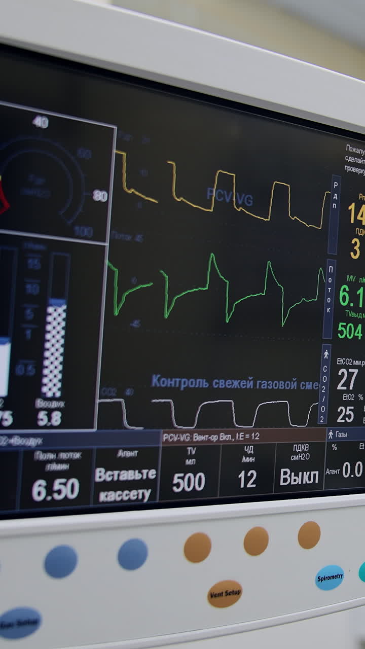 The screen of artificial lung ventilation apparatus working during surgery. Black monitor demonstration life signs of a patient under procedure. Doctors operating at backdrop. Vertical video