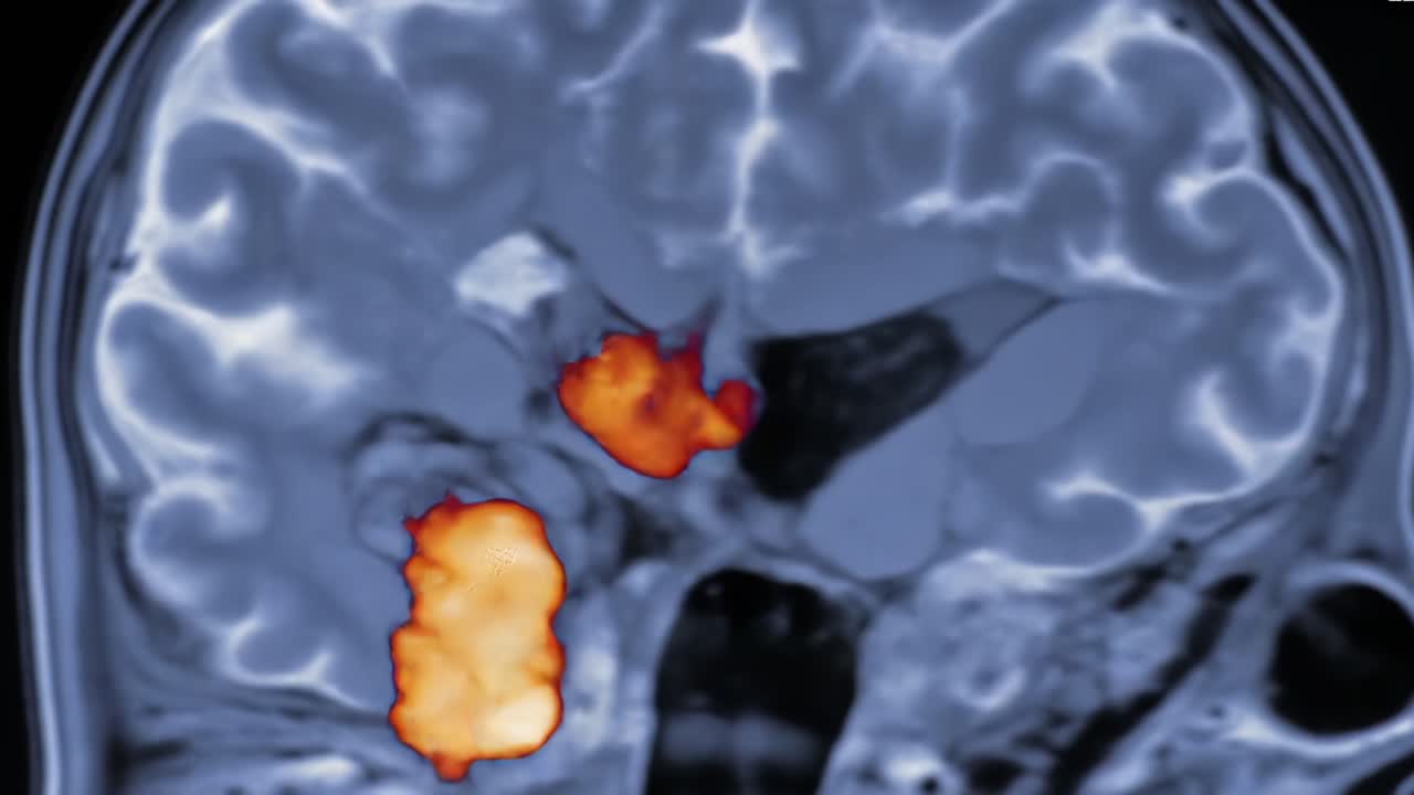 Detailed MRI Brain Scan Analysis: Observational Insights on Neural Structures and Potential Areas of Study in Neuroscience for Health Professionals and Researchers