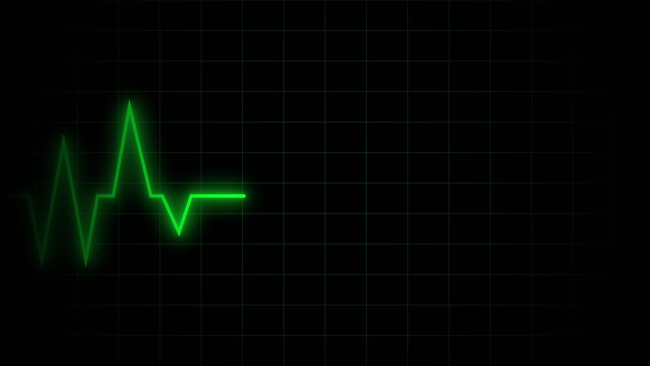 Tracciato ECG verde pulsante su griglia nera